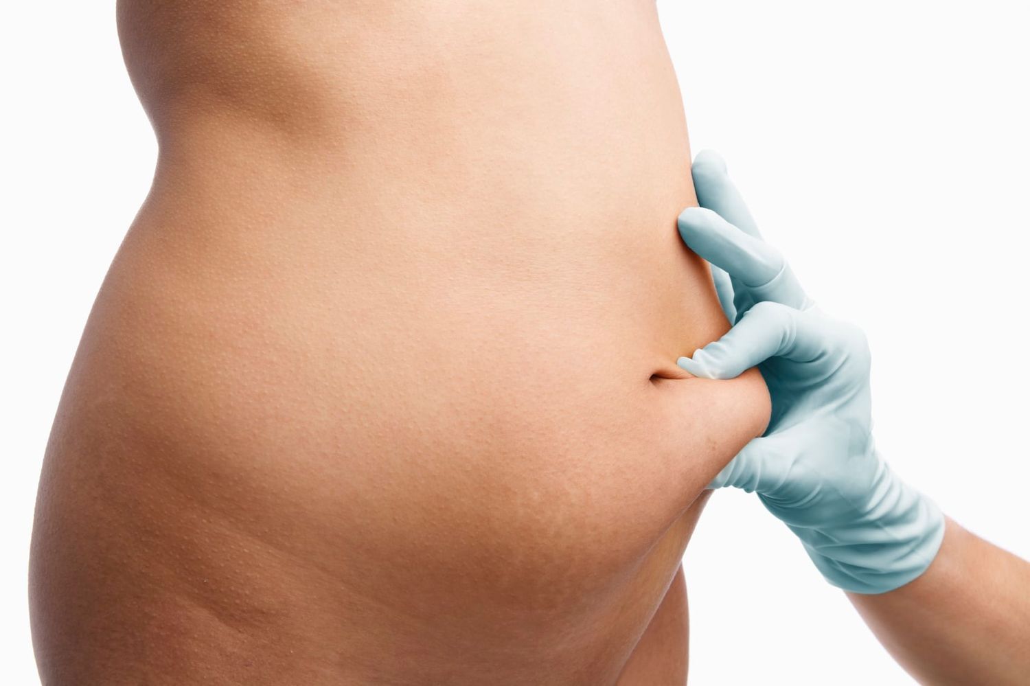 Studies Attempt To Find &quot;Maximum Liposuction Amount&quot; For Body Contouring Patients Newport Beach, CA